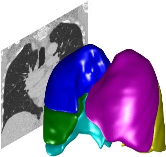 Pulmonary Toolkit - Home